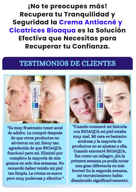 CREMA ANTIACNE BIOAQUA IMPORTADO